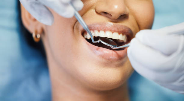 Best Cosmetic Emergency Dentistry in Forest Acres, SC