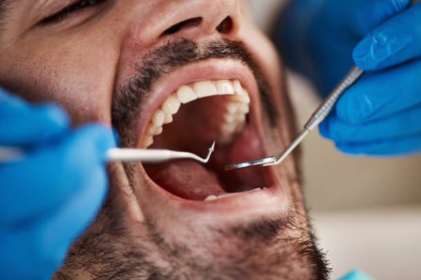 Best Emergency Treatment for Dental Infections or Abscesses in Forest Acres, SC