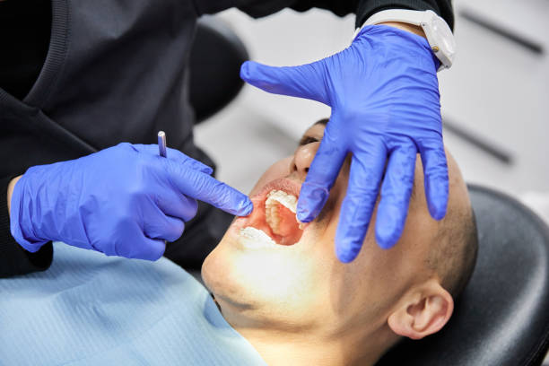 Best Urgent Care for Lost Fillings or Crowns in Forest Acres, SC