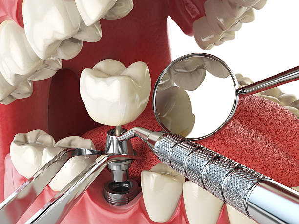 Best After-Hours Dental Trauma Care in Forest Acres, SC